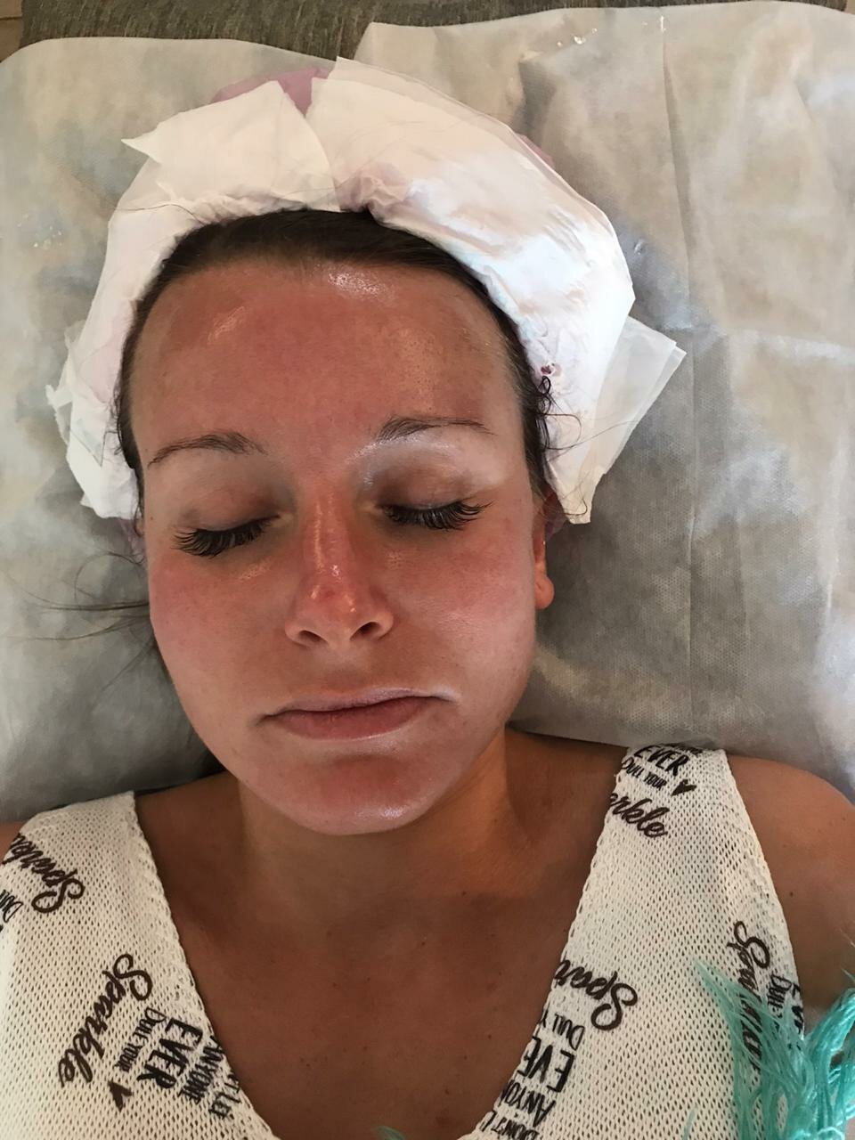 часть лица, лицо лица, лицо, распаривание лица, косметология