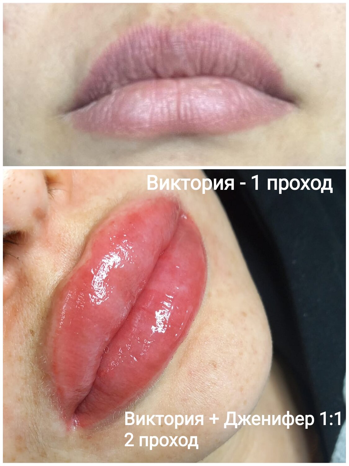 татуаж, татуаж губ, губы филлером, перманент губ, губы гиалуроновой
