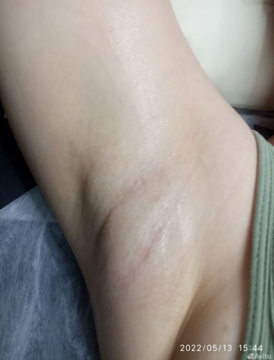 депиляция воском подмышек, восковая депиляция, шугаринг подмышек, депиляция сахаром, эпиляция подмышек