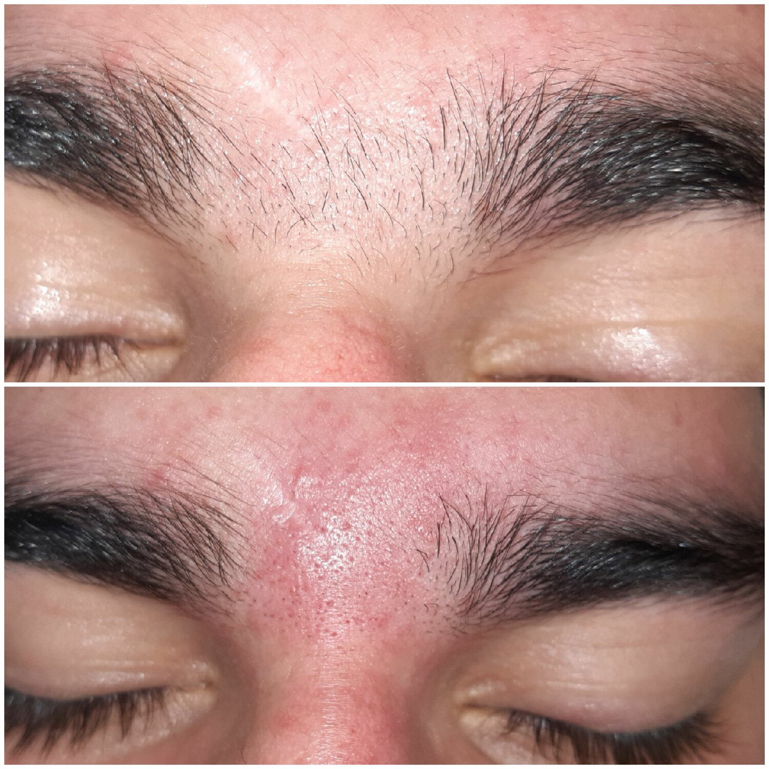 коррекция мужских бровей, коррекция бровей, мужские брови, брови, себорея на бровях