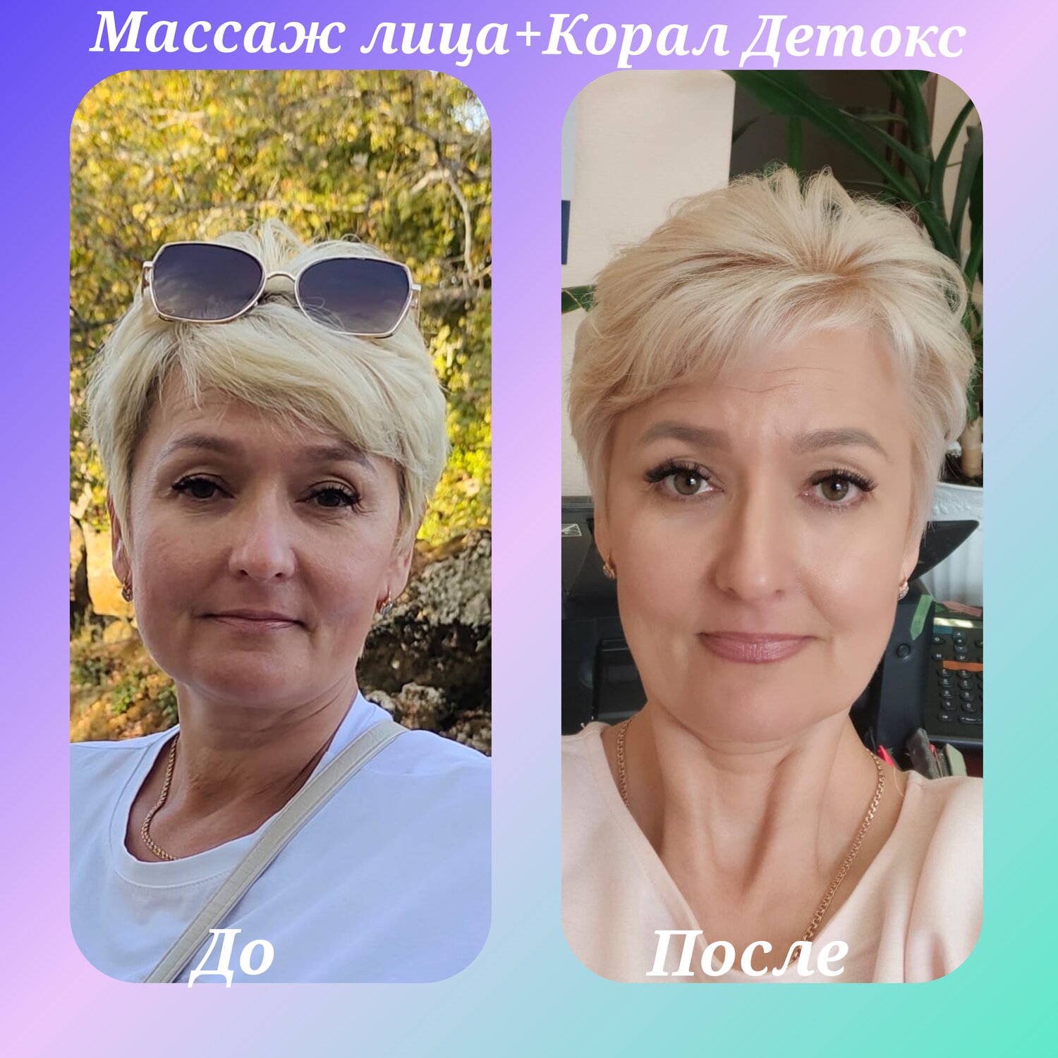 девушка, пластика лица, женщина, лифтинг макияж, макияж после 40