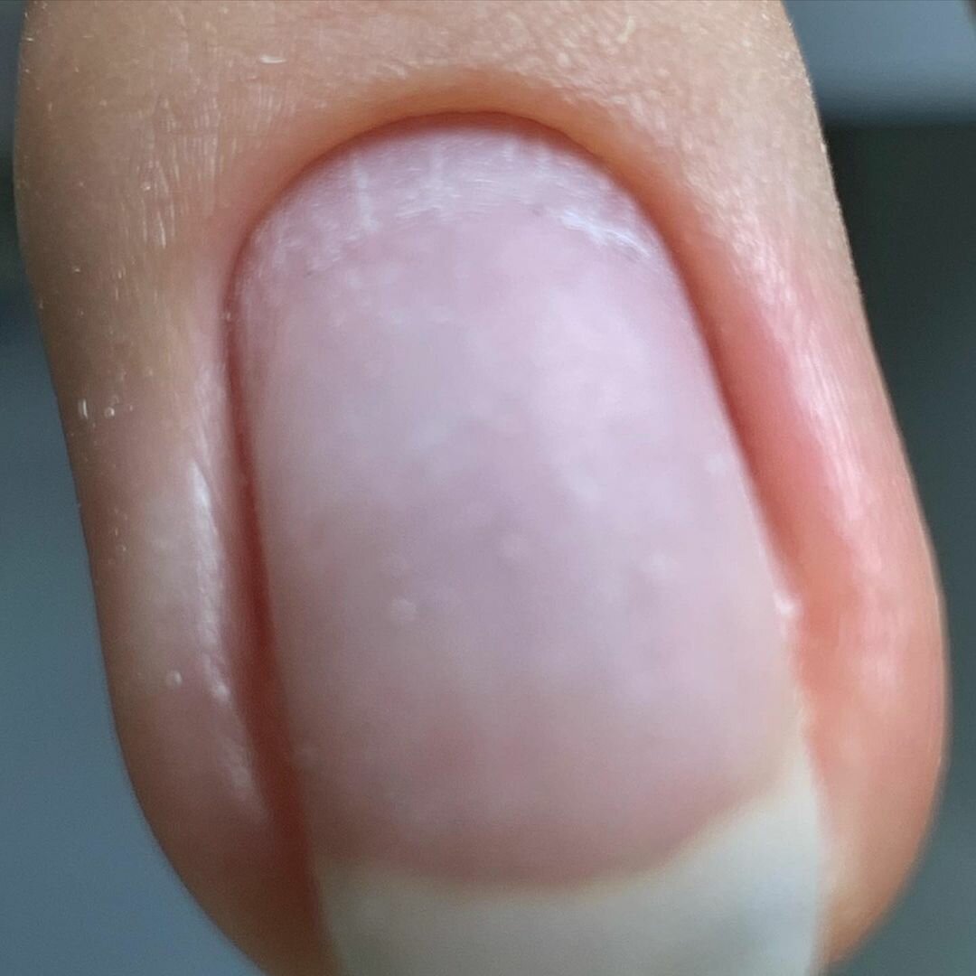 ногти, кутикула на ногтях, кутикула, nail, маникюры