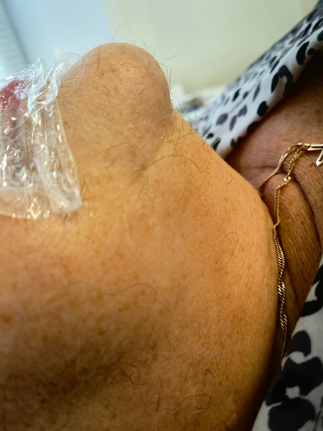 человек, следы на коже, пилинг, эпиляция, рука