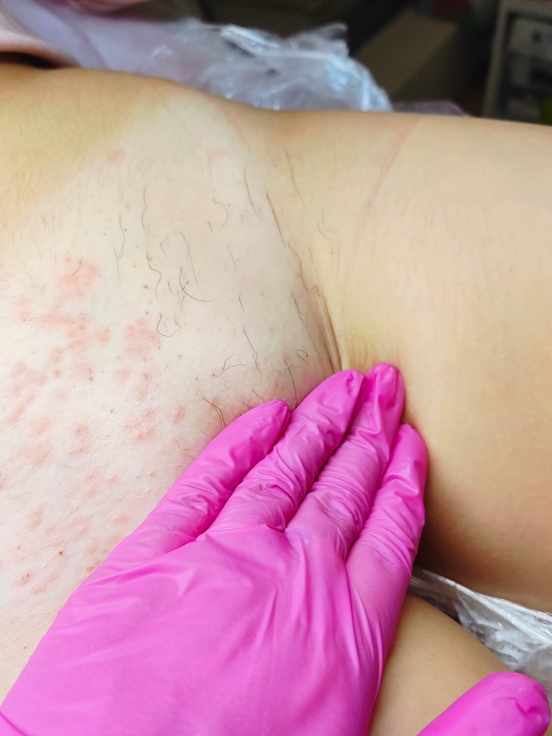 восковая депиляция бикини, восковая депиляция, глубокий шугаринг, шугаринг депиляция, депиляция