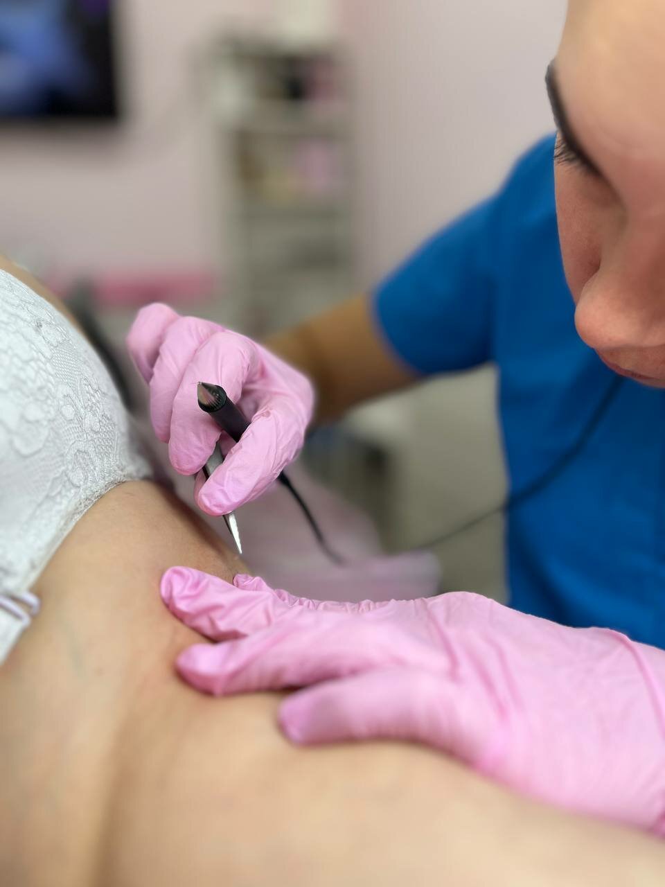 электроэпиляция, электроэпиляция лица, электроэпиляция в москве, электроэпиляция зоны бикини, депиляция воском