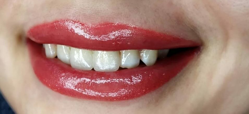 красивая улыбка зубы, белые зубы, зубы, женские улыбки с зубами, новые зубы