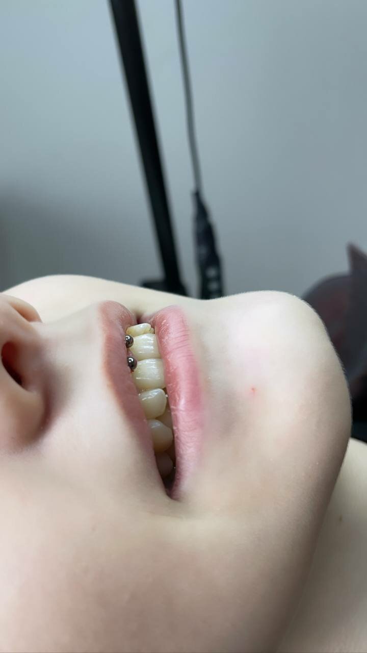 часть тела, зубы, скайсы на зубы, зубки, молочные зубы