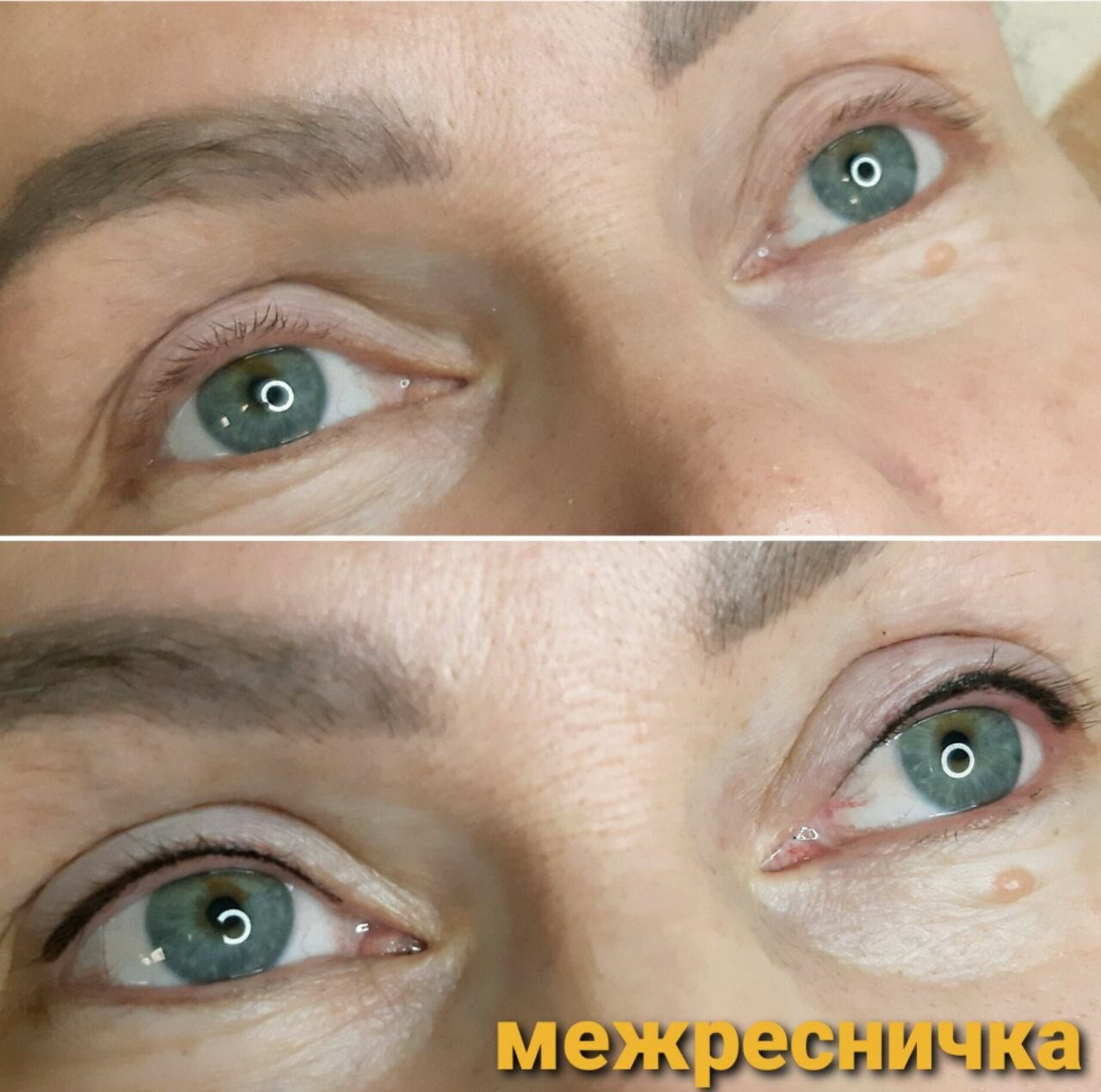 блефаропластика верхнего века, татуаж век, блефаропластика нависших век, татуаж век стрелки, татуаж