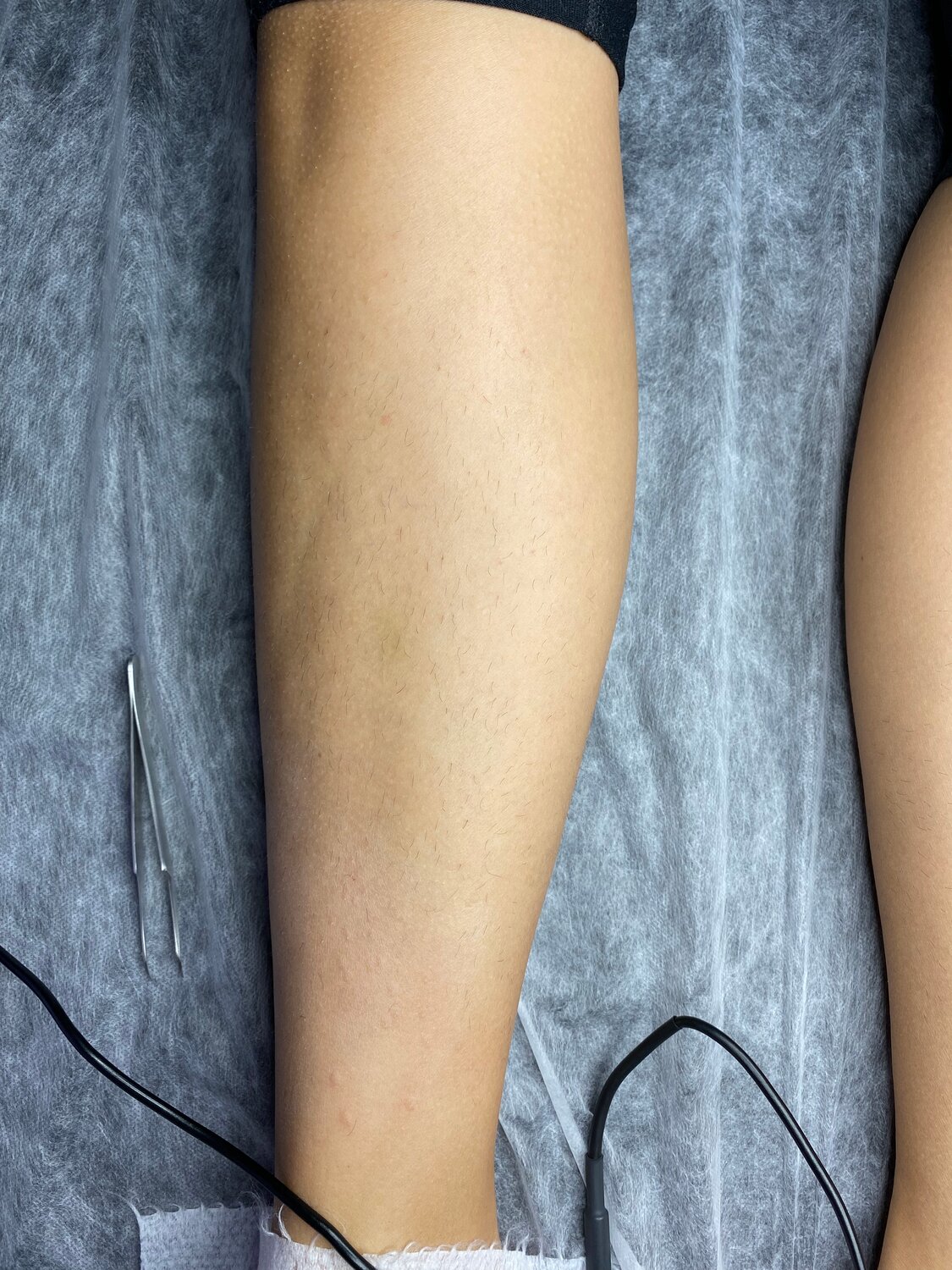 шугаринг ног, восковая депиляция, шугаринг ног направление, шугаринга, депиляции