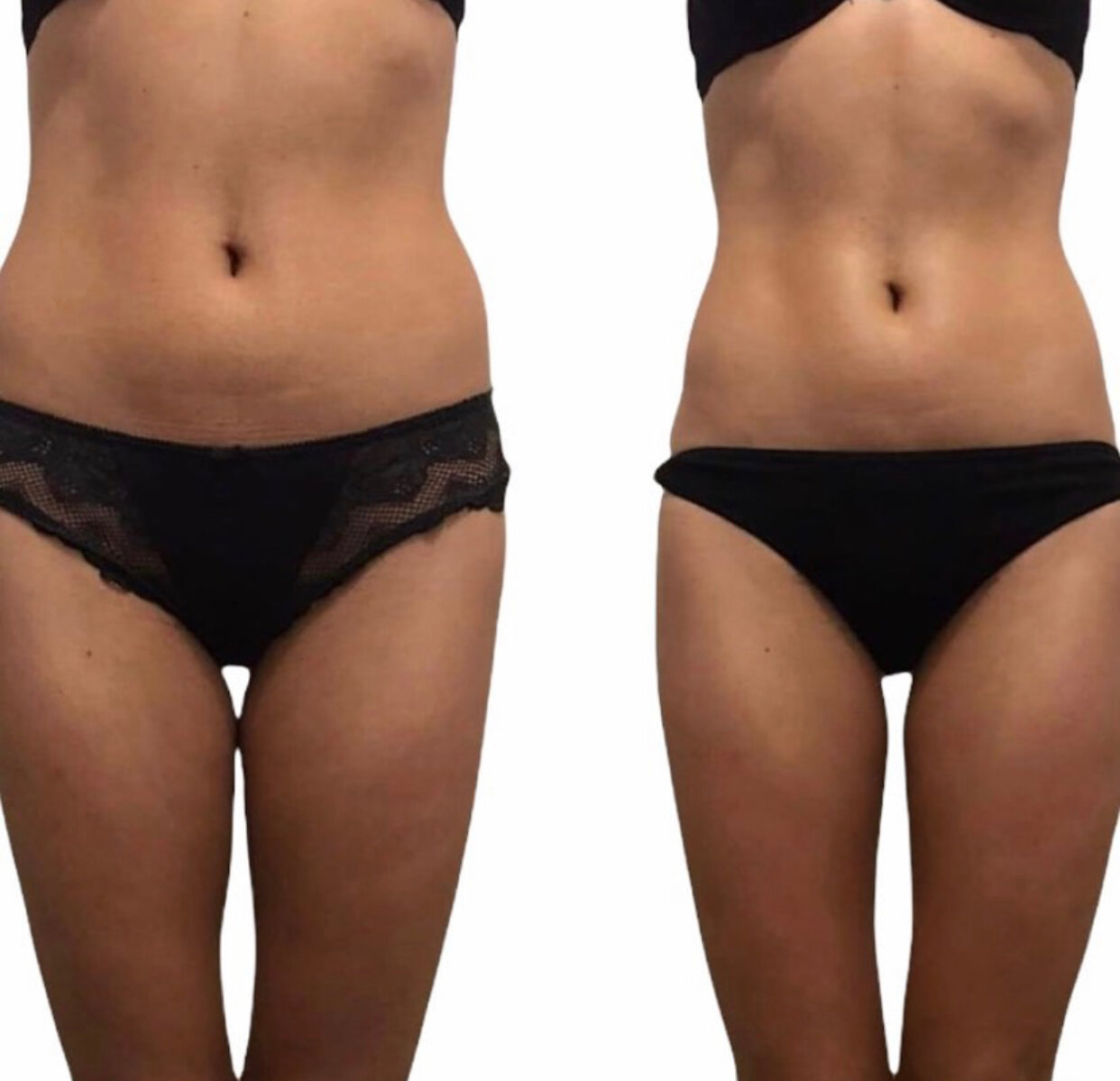 тела, бедер, талия, уши на талии, фигура