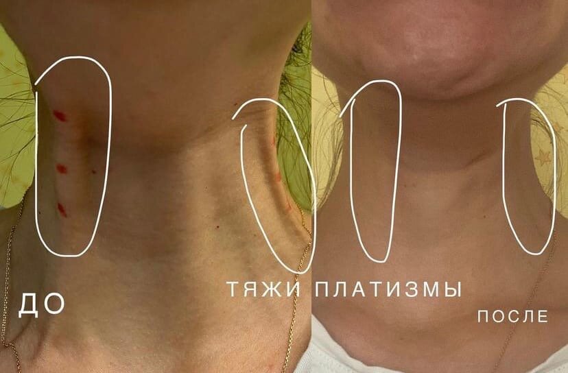 часть тела человека, морщины кольца венеры, после, шея выдает возраст, тела