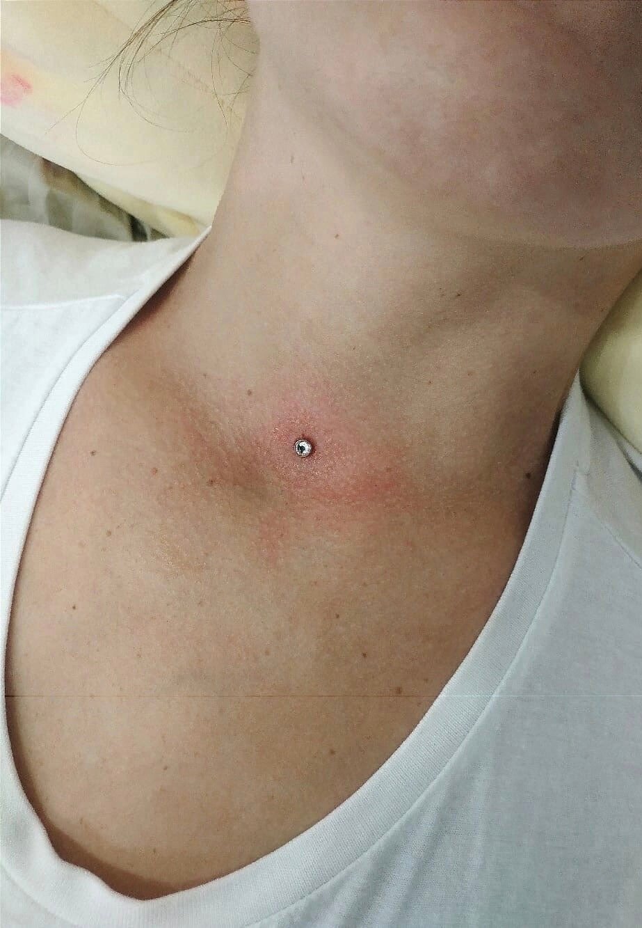 микродермал, пирсинг микродермал, пирсинг на шее микродермал, микродермалы, микродермал фф