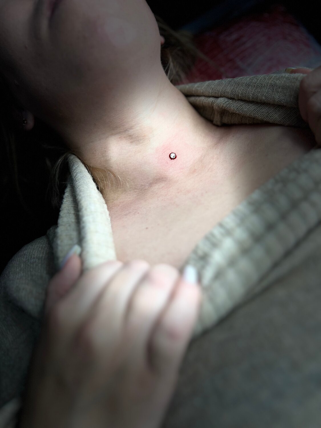 микродермал пирсинг, микродермал на шее, прокол шеи микродермал, пирсинг на шее, микродермал жемчужина