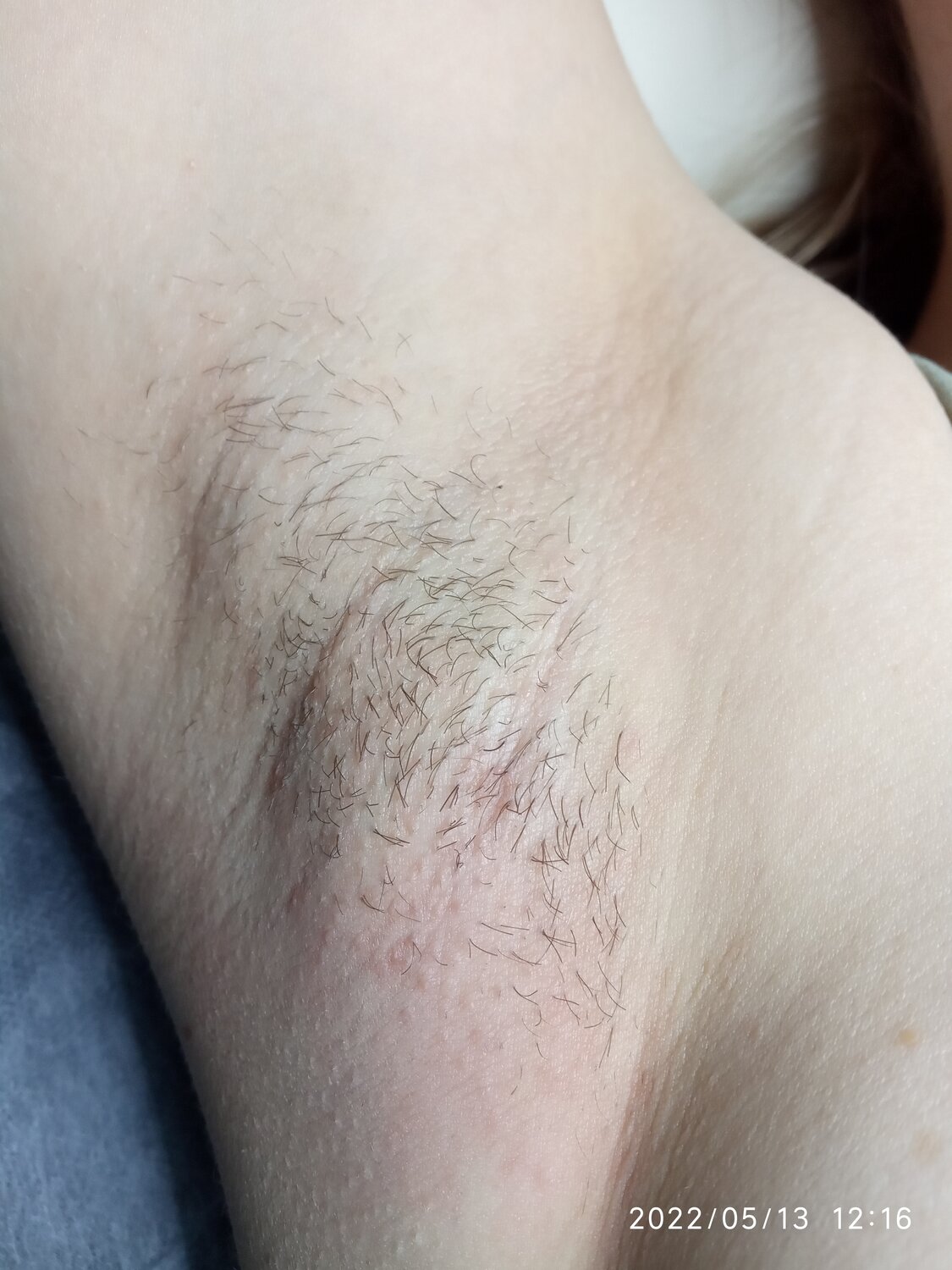 восковая депиляция, шугаринг, эпиляция, шугаринг глубокое, депиляция