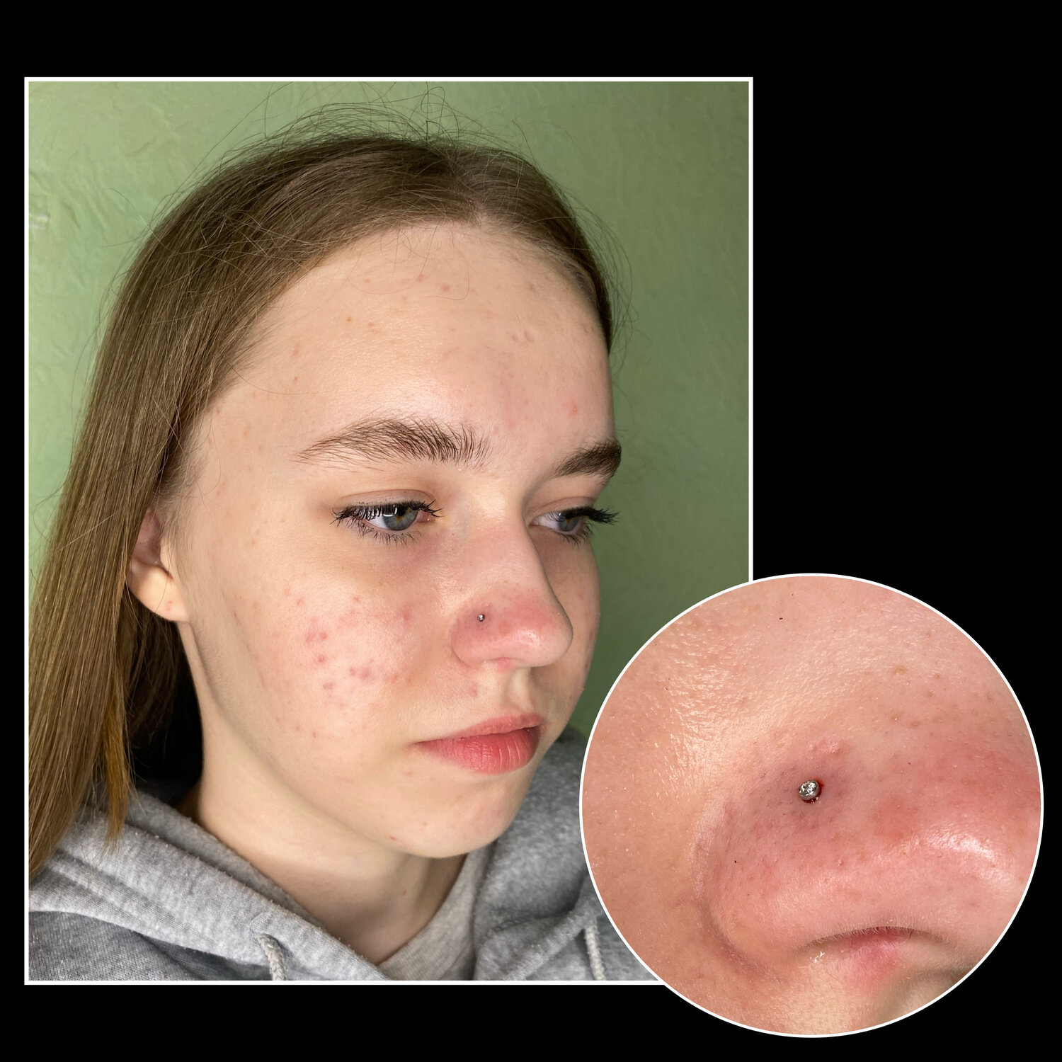 прокол крыла носа без серёжки, прокол носа, часть лица, нос пирсинг, пирсинг на лице у девушек