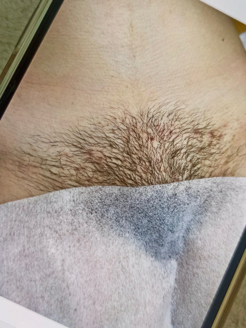 восковая депиляция, депиляция, шугаринг депиляция, шугаринг глубокое, сахарная депиляция