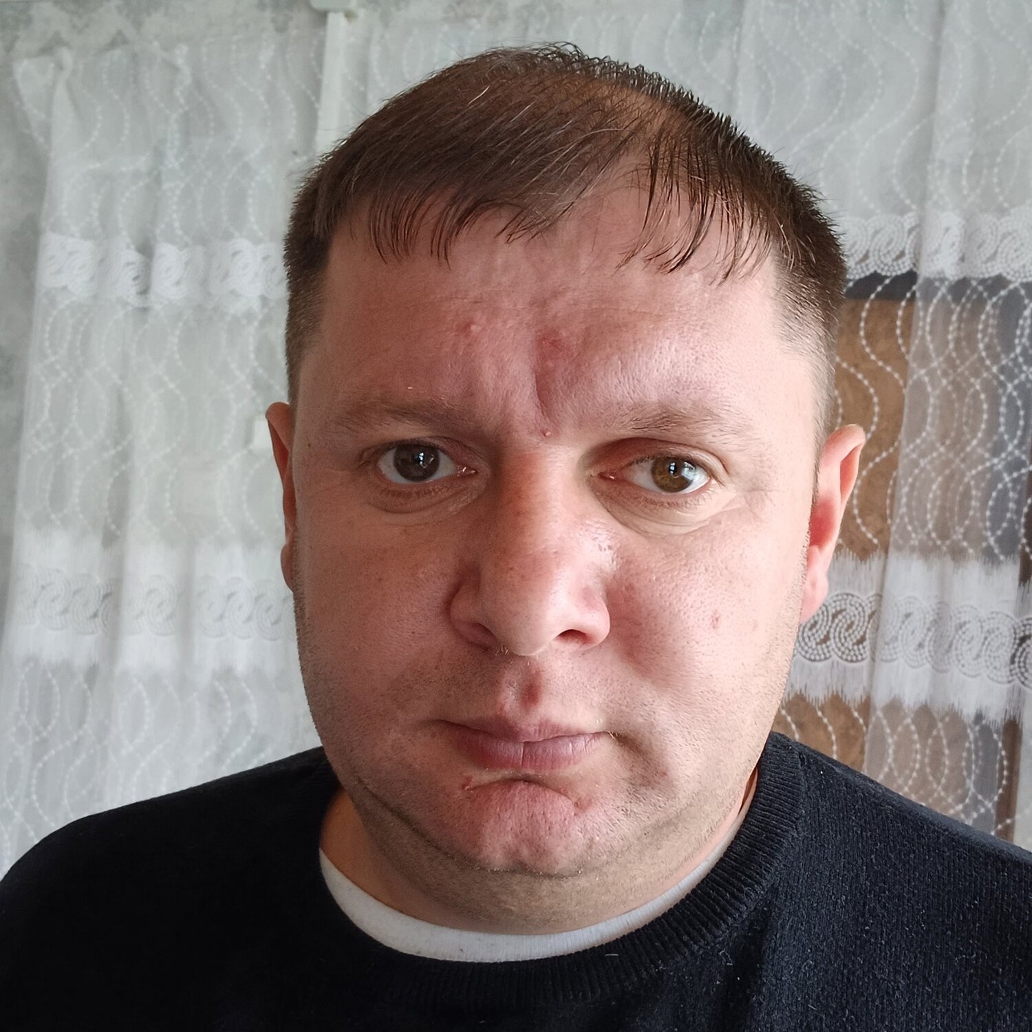 Рупа Понтанесеко