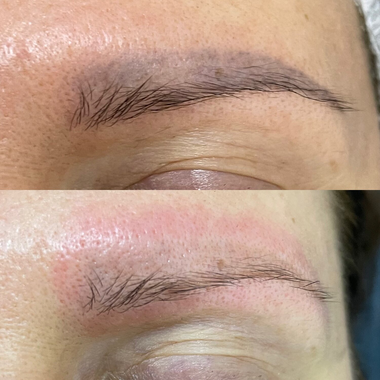 татуаж, удаление татуажа, микроблейдинг волосковая техника, татуаж бровей, татуаж век