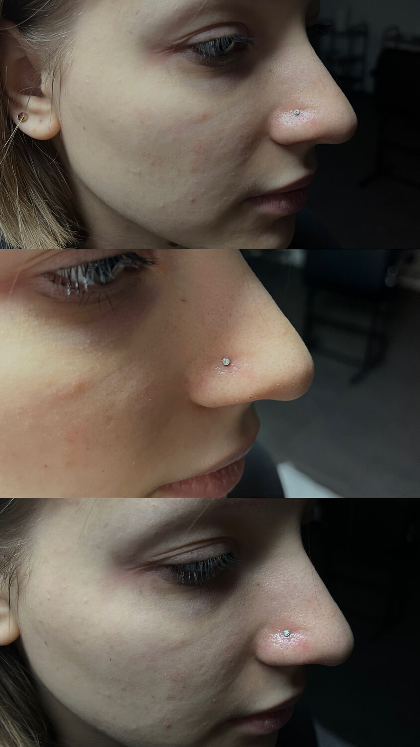 прокол нос, пирсинг крыла носа, прокол крыла носа, пирсинги носа, прокол носа нострил