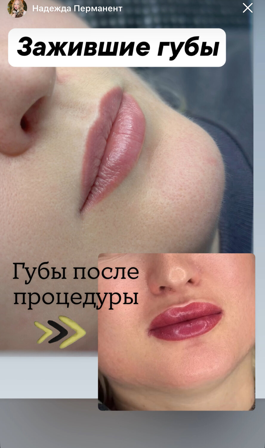 зажившие губы после перманентного макияжа, губы после перманентного макияжа, губы татуаж, губы после татуажа, губы после перманента по дням