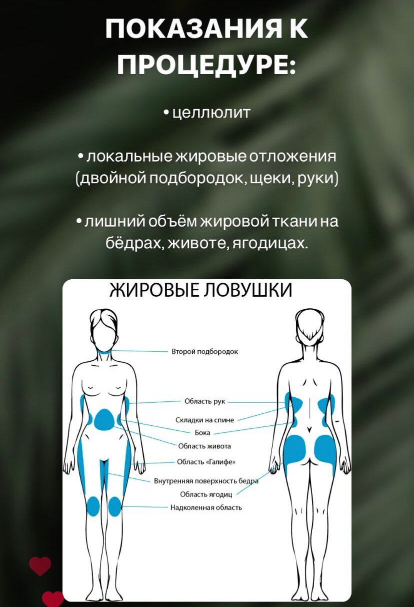 бедра и ягодицы, тела, массаж вакуумный, жировые отложения, жировые ловушки