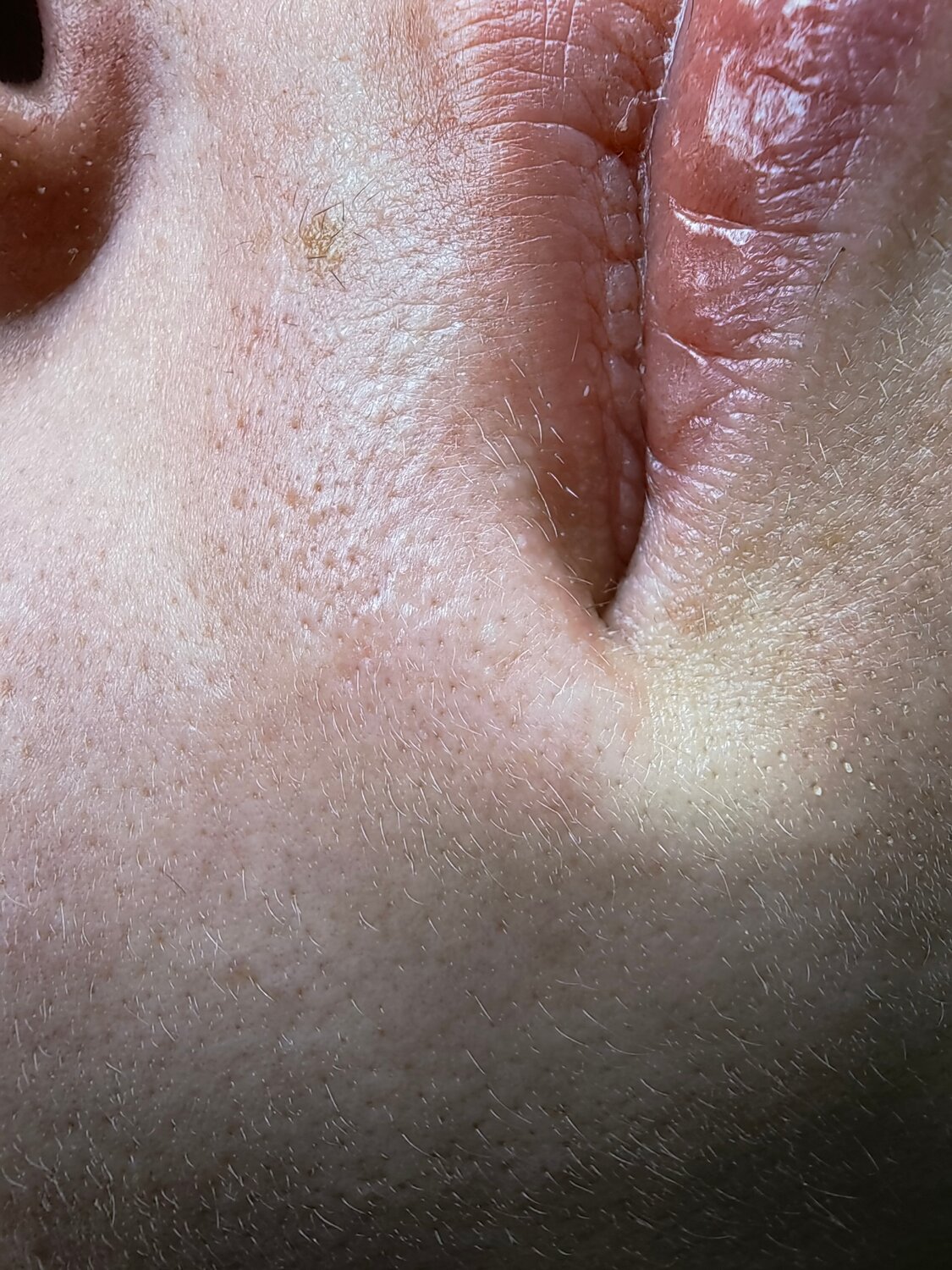 губы 👄, перманентный макияж губы, макияж губ, электроэпиляция, человек