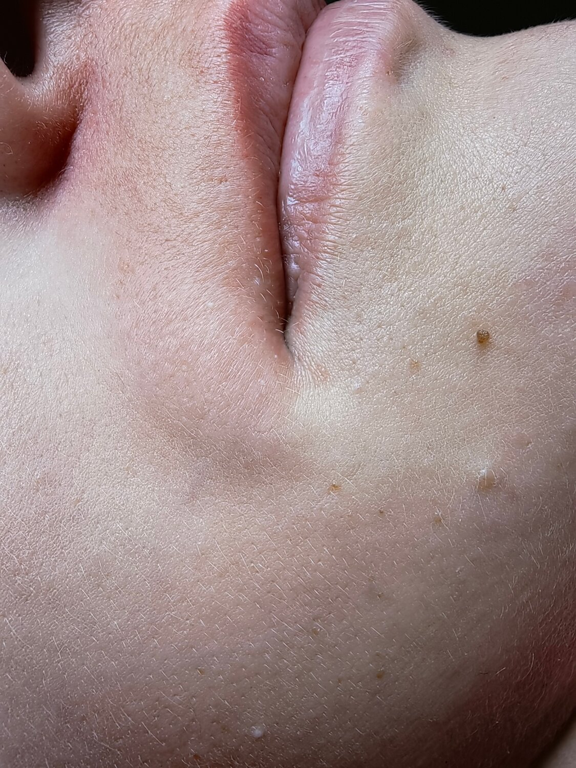 губы, депиляция лица, человек, лицо, чистка лица