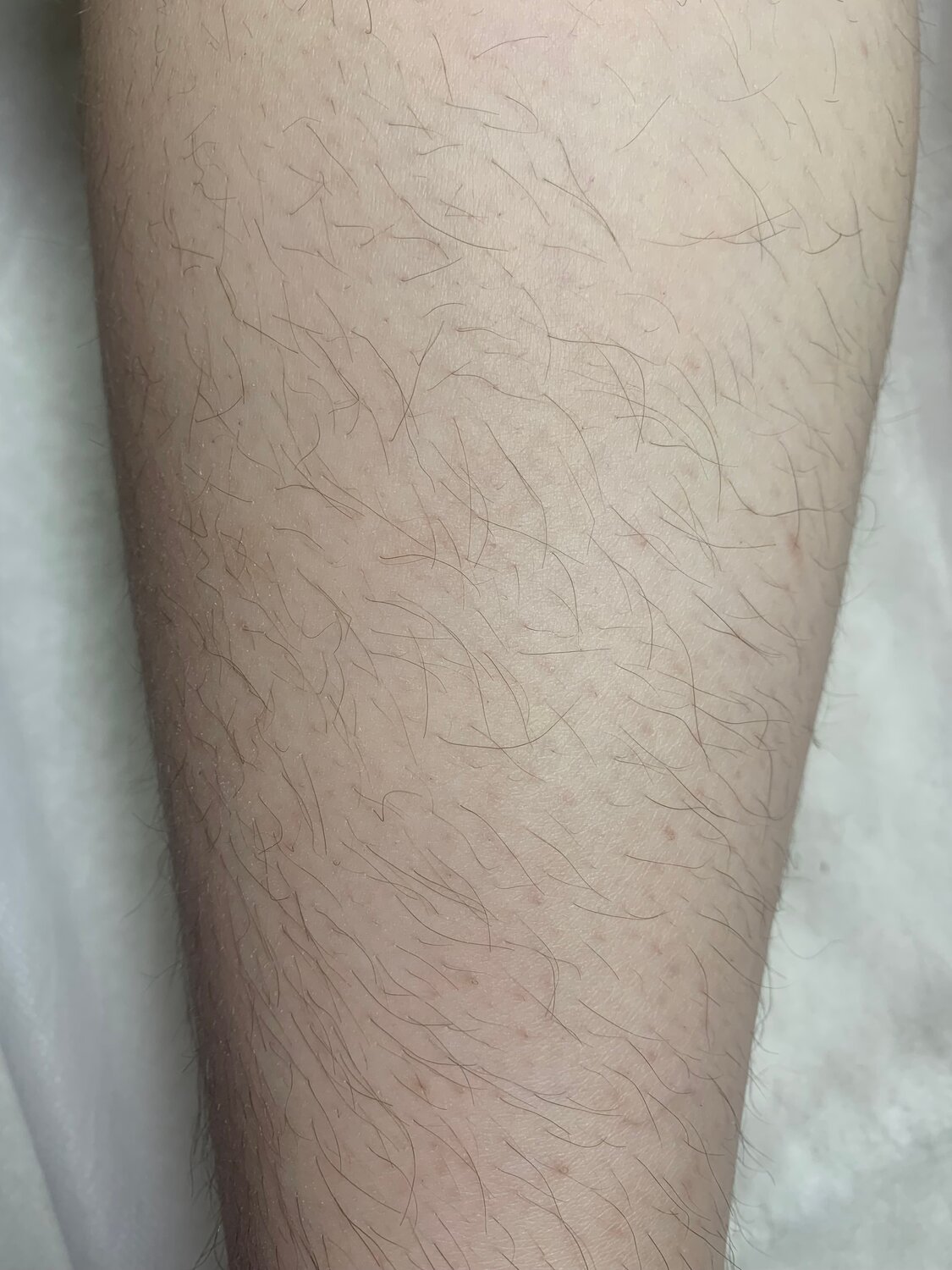 часть тела, восковая депиляция, депиляция воском, шугаринг депиляция, сахарная депиляция