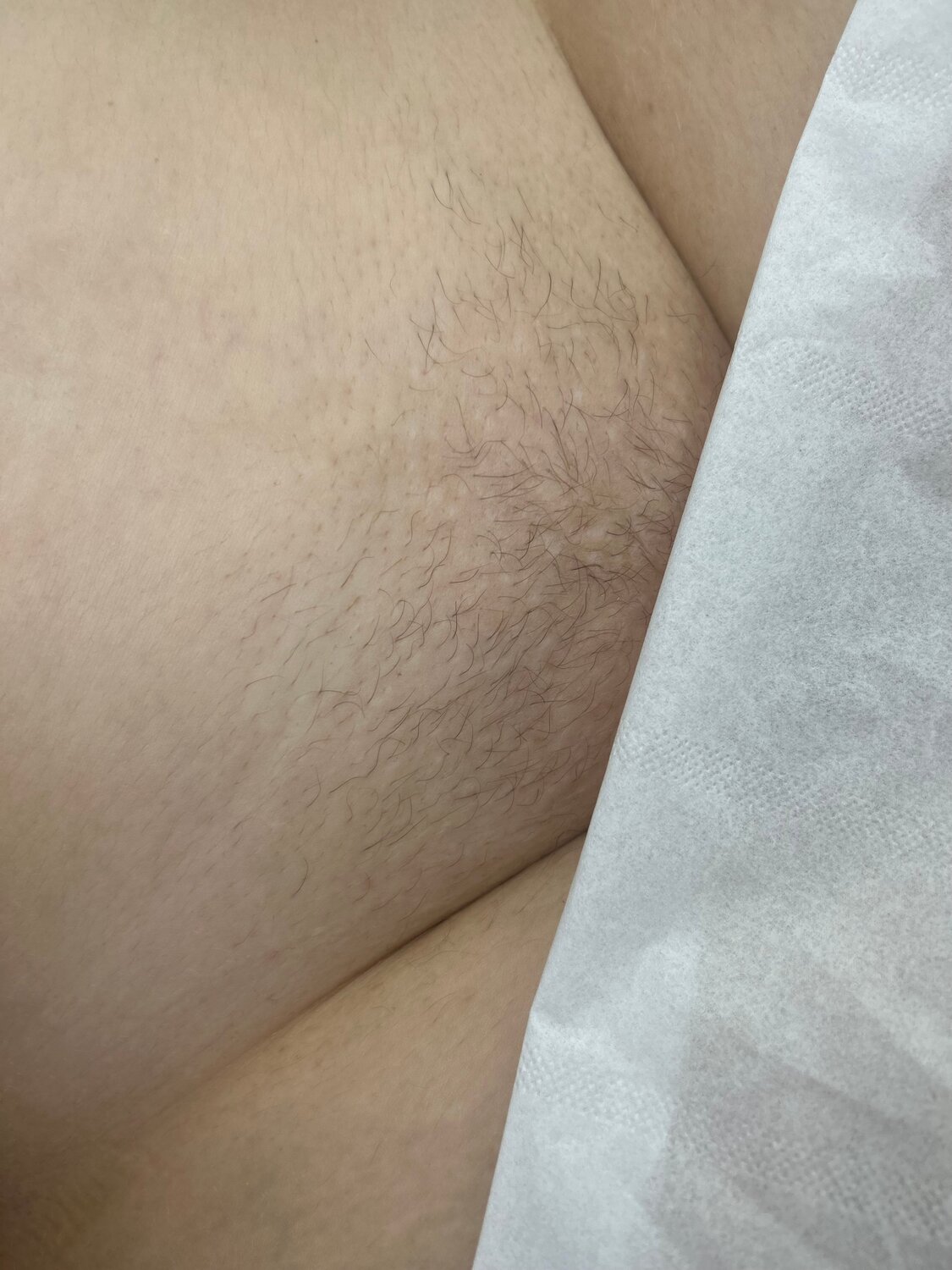 восковая депиляция бикини, восковая депиляция, депиляция, шугаринг депиляция, восковая эпиляция