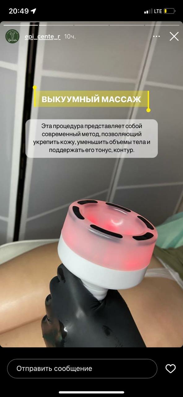 вакуумный массаж, вакуумный массажер для тела, вакуумный массажер, массажёр электрический для тела, антицеллюлитный массажер